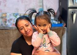 Paula de 7 años nacida con síndrome de Robinow y su madre Gabriela.
