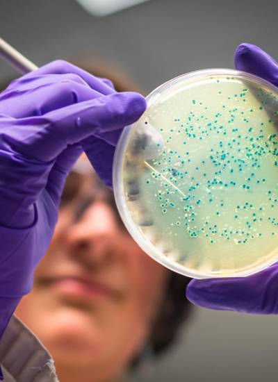 La bacteria leptospira suele estar en las heces u orina de ciertos animales infectados.